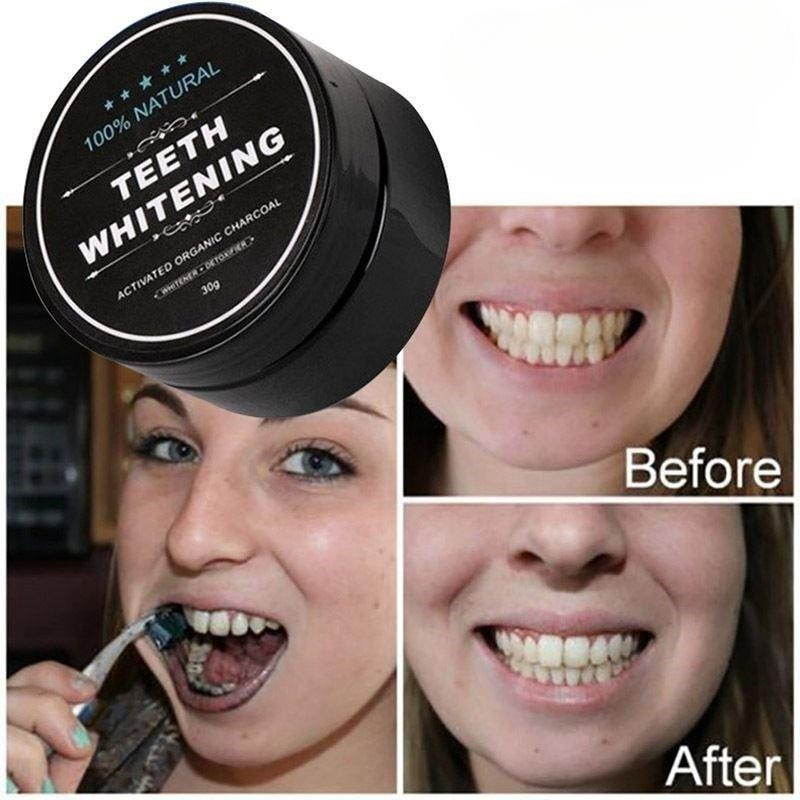 1 Kutu Aktif Kömür Diş Beyazla - Teeth Whitening Filter incelemesi ve fiyatı