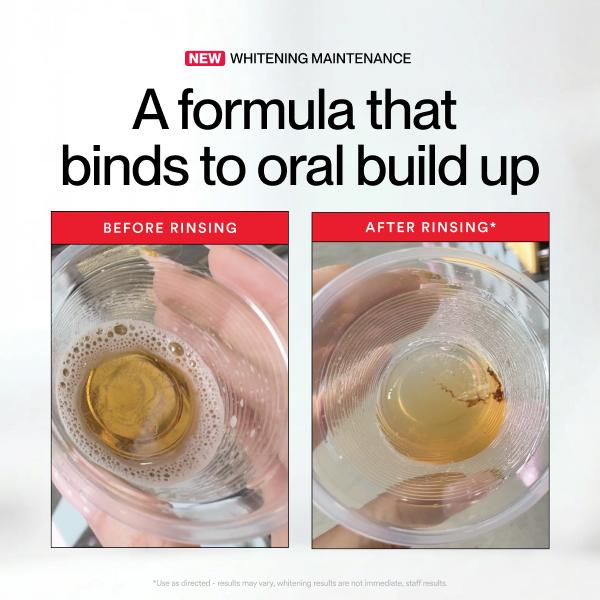 Hismile ID Beyazlatıcı Leke Gi - Whitening Mouthwash incelemesi ve fiyatı
