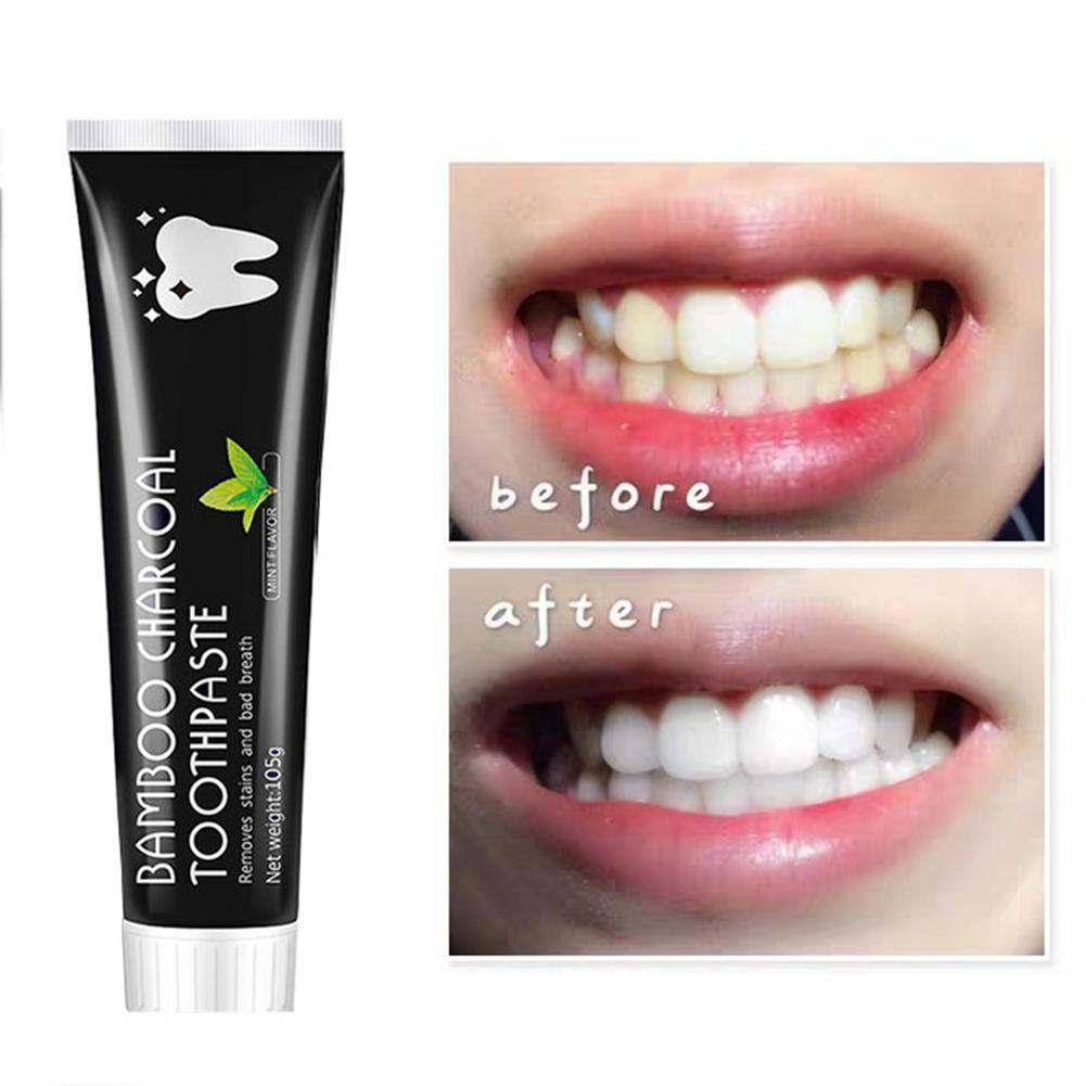Bambu Kömürü Diş Macunu Beyazl - Teeth Whitening Filter incelemesi ve fiyatı